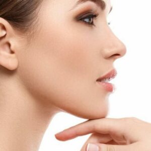 chin augmentation