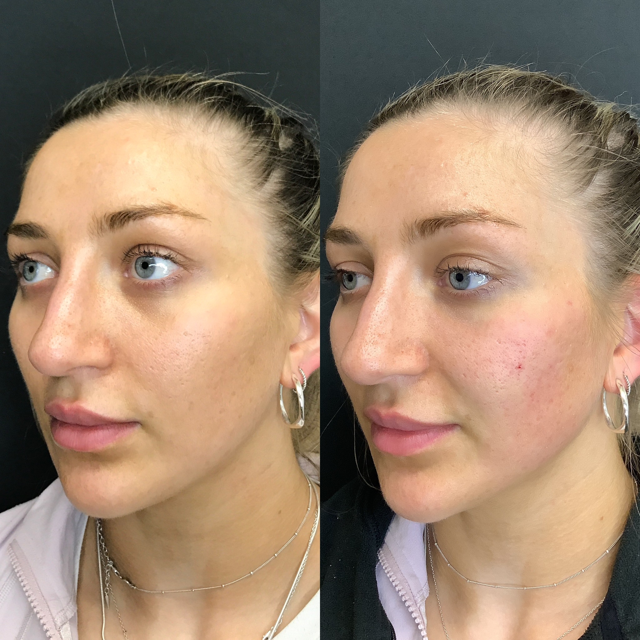 Tired Eyes Solution - Blog